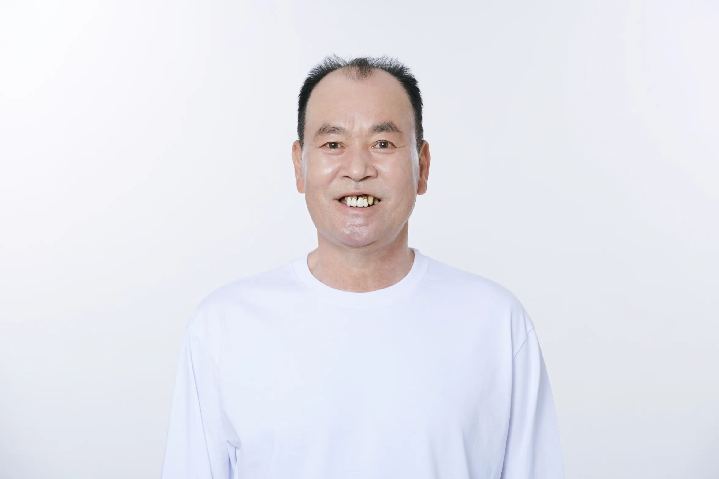 キムOO様 治療前の写真