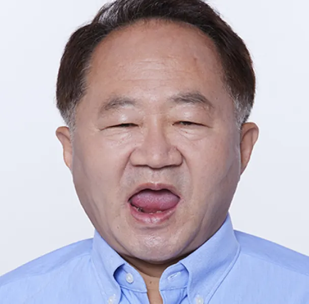 チェ**様（60代） 治療前