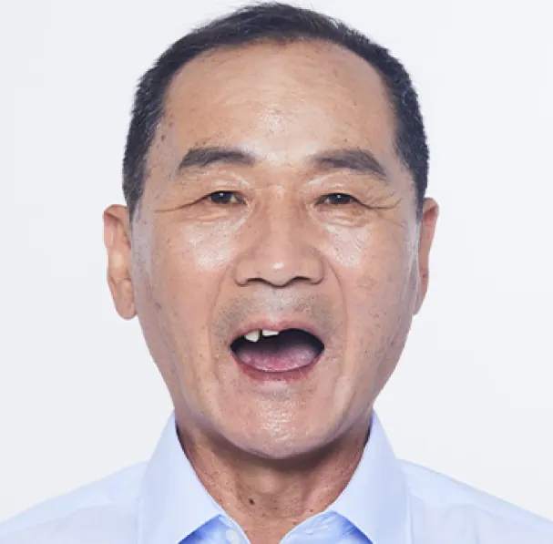 チョン**様（60代） 治療前
