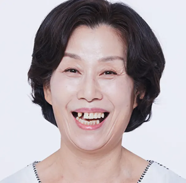 チョン**様（60代） 治療前