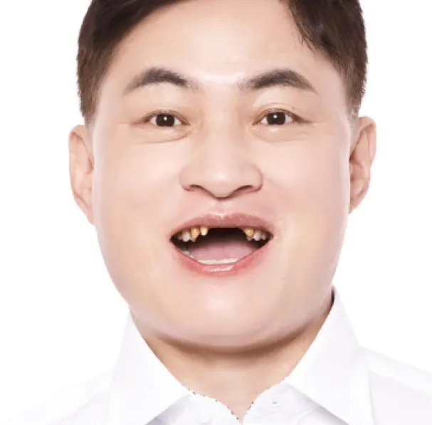 イ**様（40代） 治療前