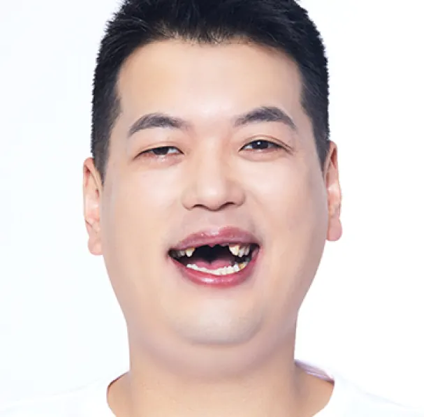 パク**様（30代） 治療前