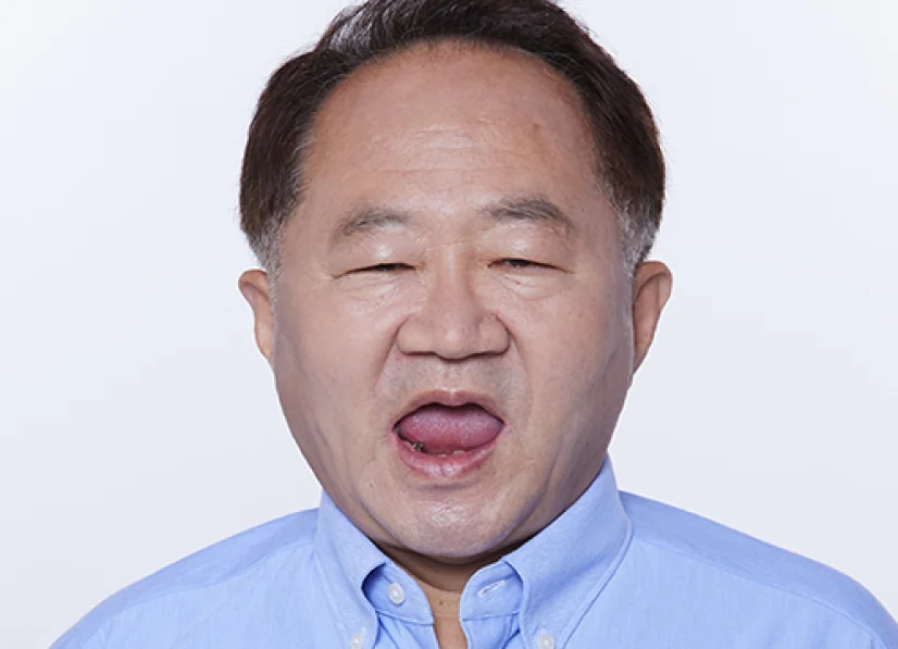 チェOO様 治療前の写真