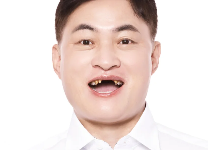 イOO様 治療前の写真
